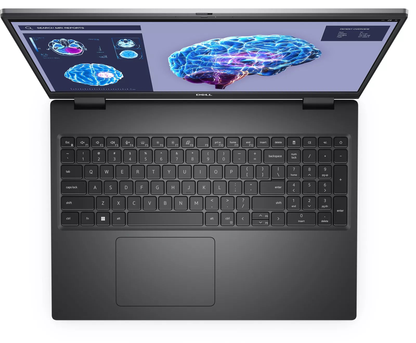 Dell Precision 7680 – Core i9 13th Gen Laptop with 16GB Dedicated GPU, 32GB DDR5 RAM and 1TB SSD - mobile Workstation - Pakistan FREE Delivery.